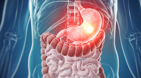 Gastroenterologia: Cuide do seu aparelho digestivo
