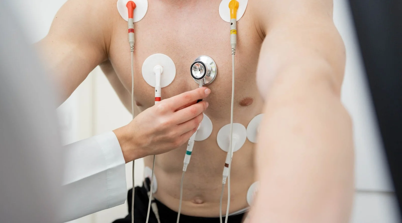 Avaliação cardiológica antes da cirurgia: o que o cirurgião precisa saber do seu coração